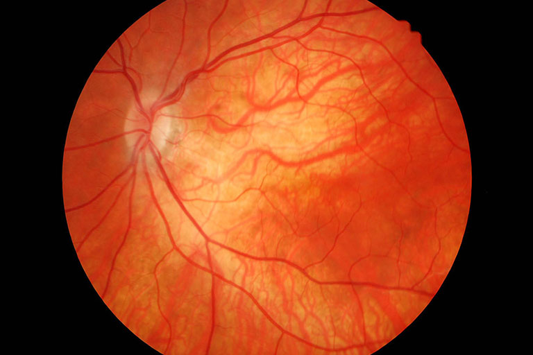 Tudo que você precisa saber sobre retina
